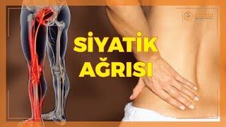 SİYATİK HASTALIĞI