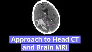 Approach to Head CT and Brain MRI