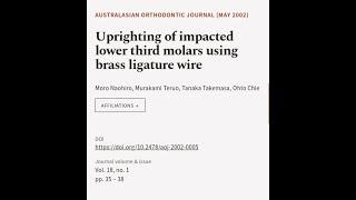 Uprighting of impacted lower third molars using brass ligature wire | RTCL.TV