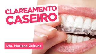 PASSO A PASSO: Como funciona o Clareamento Dental Caseiro - Dra. Mariana Zeitune