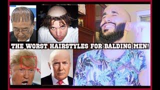 THE WORST HAIRSTYLES FOR BALDING MEN! | Avoid These At ALL Costs If You're Losing Your Hair