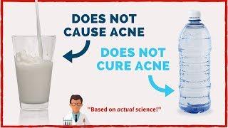 Here's The TRUTH About Acne (Based on Actual Science)