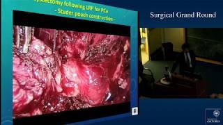 Oxford University surgical lectures: Cases of complicated surgery for “high-risk” prostate cancer