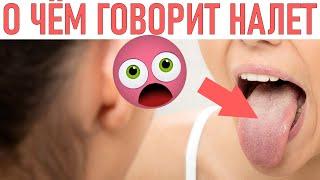 НАЛЕТ НА ЯЗЫКЕ | Что означает налёт на языке и как от него избавиться