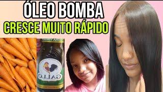 O CABELO CRESCE EM 15 DIAS COM APENAS 3 INGREDIENTES! COMBATE A QUEDA E A QUEBRA CAPILAR!