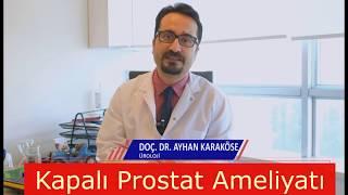 Plazma Kinetik Sistem Kapalı Prostat Ameliyatı - Üroloji Uzmanı Prof.Dr. Ayhan Karaköse