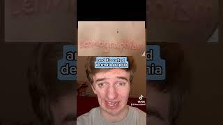 People With This Condition Can Write On Their Skin!