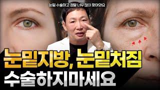 [ENG/JP] 눈밑지방 없애는 법! 수술 전 다시 생각해보세요. 이런분들은 불만족할 확률이 높습니다.