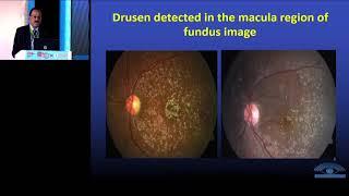 AIOC2019 GP098 Topic 12  AI & Ophthalmology:   Dr  Kim Ramaswamy