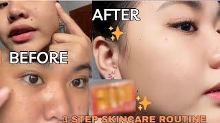 How i achieve KOREAN SKIN!? using BEAUTY VAULT REJUVENATING SET | My Honest Review!!