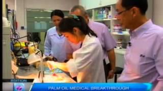 Palm Oil Medical Breakthrough for Stroke Patients