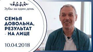 Отзывы пациентов | All-on 4 | Сеть клиник Зубы за 1 день | СПб | Нечаев Виктор Владимирович