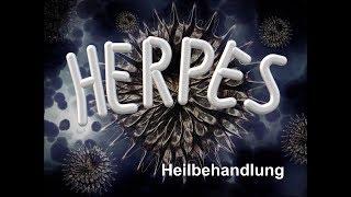 Herpes // Heilbehandlung