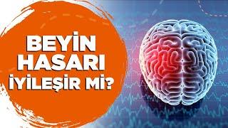 Beyin Hasarı ( Serebral  Palsi - Spastik Çocuk ) İyileşir mi?