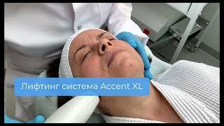 Accent XL: безоперационная липосакция | Гранд Клиник Екатеринбург