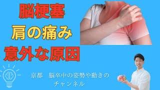 「脳梗塞　肩の痛み　意外な原因」京都オステオパシーセンターOQ　四条大宮