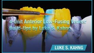 4-unit Low-Fusing Veneer Build-Ups by Luke S. Kahng