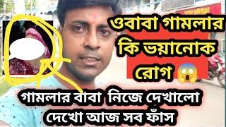 দেখো গামলার বাবা নিজে দেখালো গামলার কি নতুন ভয়ানোক রোগ হয়েছে @MyVillageLifeSandip12