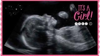 20 weeks Ultrasound GIRL part 1