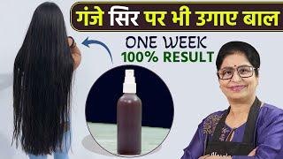 कितने भी खराब बालों का झड़ना रोक कर - उगाये नए बाल | DIY Serum, Pack & Drink for Extreme Hair Growth