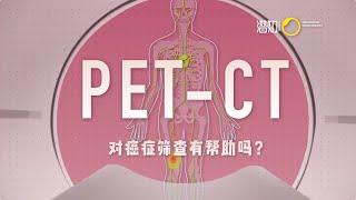 「健康科普」体检的误区和骗局：PET-CT 是什么？对癌症筛查真的有帮助吗？