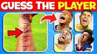 Who Got INJURY? 🩸Comparison INJURY Moments of Football Player! Football Quiz | Ronaldo,Messi