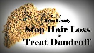 How To Stop Hair Loss and Treat Dandruff At Home Treatment and make hair grow long really fast