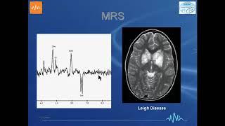 ISMRM MR Academy - Metabolic Disorders