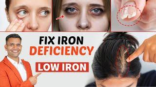 How To Treat  Iron Deficiency ( Low Iron ) Naturally | Increase Hemoglobin Naturally