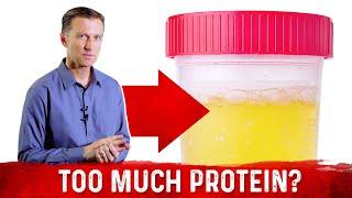 Top 5 Symptoms Of Eating Too Much Protein – Dr.Berg