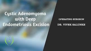 Cystic Adenomyoma with Deep Endometriosis Excision