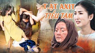 Giật Chồng Bị T.ẠT AXIT Hủy Hoại Dung Nhan Tiểu Tam Hèn Hạ | PHIM NAM BỘ GÂY CẤN HẤP DẪN NHẤT