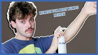 remedy for body bumps review