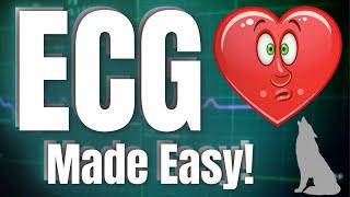 ECG Interpretation - Made EXTREMELY Easy!!!