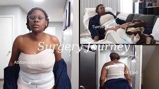 My Post-Op Tummy Tuck Journey After 40