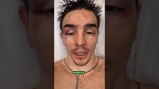 Michael Conlan First Words after Vicious KO by Leigh Wood