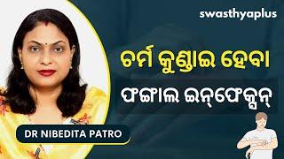 ଫଙ୍ଗାଲ ଇନ୍‌ଫେକ୍ସନ୍‌: କେମିତି କରିବେ ଦୂର? | Fungal Infection in Odia | Dr Nibedita Patro