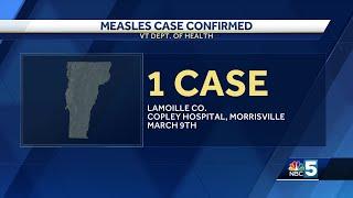 Vermont child tests positive for measles, health department says