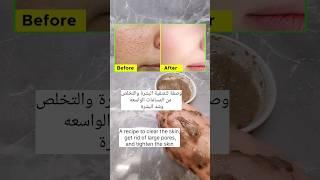 أقوى وصفة لسد المسامات الواسعة وتصفية وشد البشرة