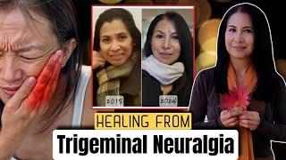 Breaking Free from Trigeminal Neuralgia - Sis. Miriam's Remarkable Healing Testimony.