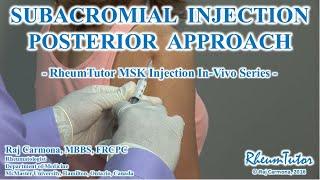 SUBACROMIAL INJECTION POSTERIOR APPROACH - In-Vivo Series