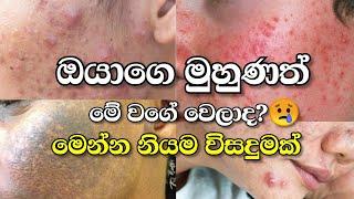 ඔයාගෙ ලස්සන මූණත් මේ වගෙ කැත වෙලාද? එහෙනම් මෙන්න නියම විසදුමක් | Damage Repair Treatment