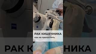 Каковы обязательные обследования для раннего выявления колоректального рака #онкология #онколог