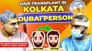 Hair Transplant Cost || Best Hair Transplant In Kolkata || Cosmo Aid