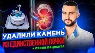 Удалили камень в единственной почке - отзыв пациента