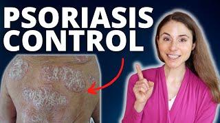 TOP 5 TIPS TO CONTROL PSORIASIS FLARES  DERMATOLOGIST @DrDrayzday