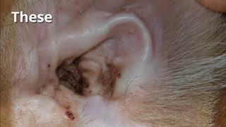 Can hearing loss be reversed? Types of hearing loss which can be reversed