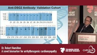 Dr. Robert Hamilton:  A novel biomarker for arrhythmogenic cardiomyopathy