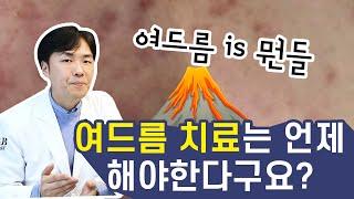 여드름 관리해도 계속 생기는 이유가 뭐냐면요! | 여드름 없애는 법 | 연세에이앤비 피부과 이해진원장