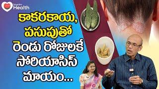 Psoriasis Cure | కాకరకాయ, పసుపుతో సోరియాసిస్ మాయం.. Dr. Ch Madhusudana Sarma | TeluguOne Health